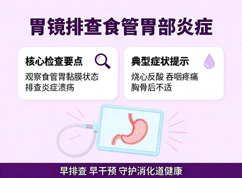 胃镜排查食管胃部炎症