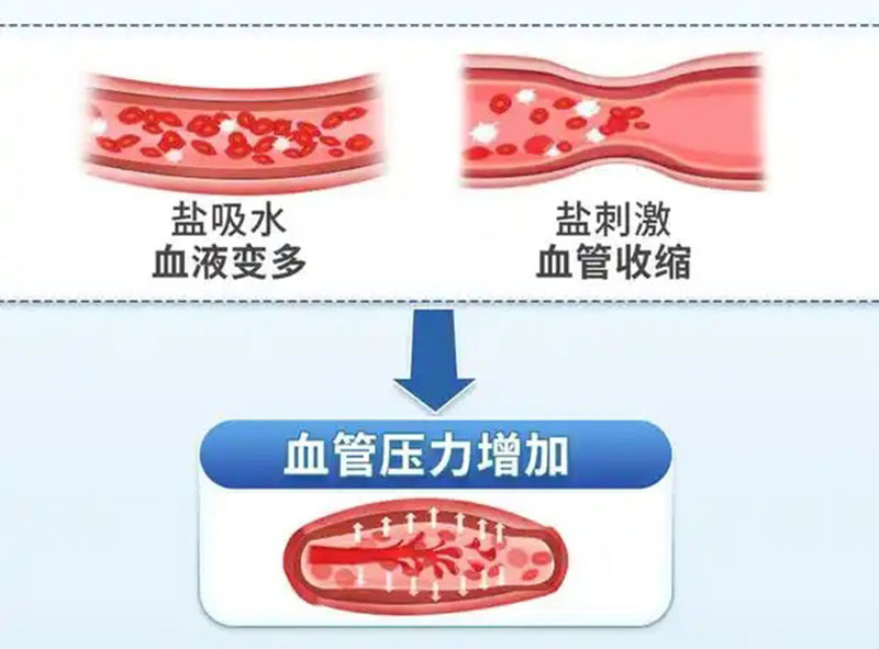 高盐饮食伤血管